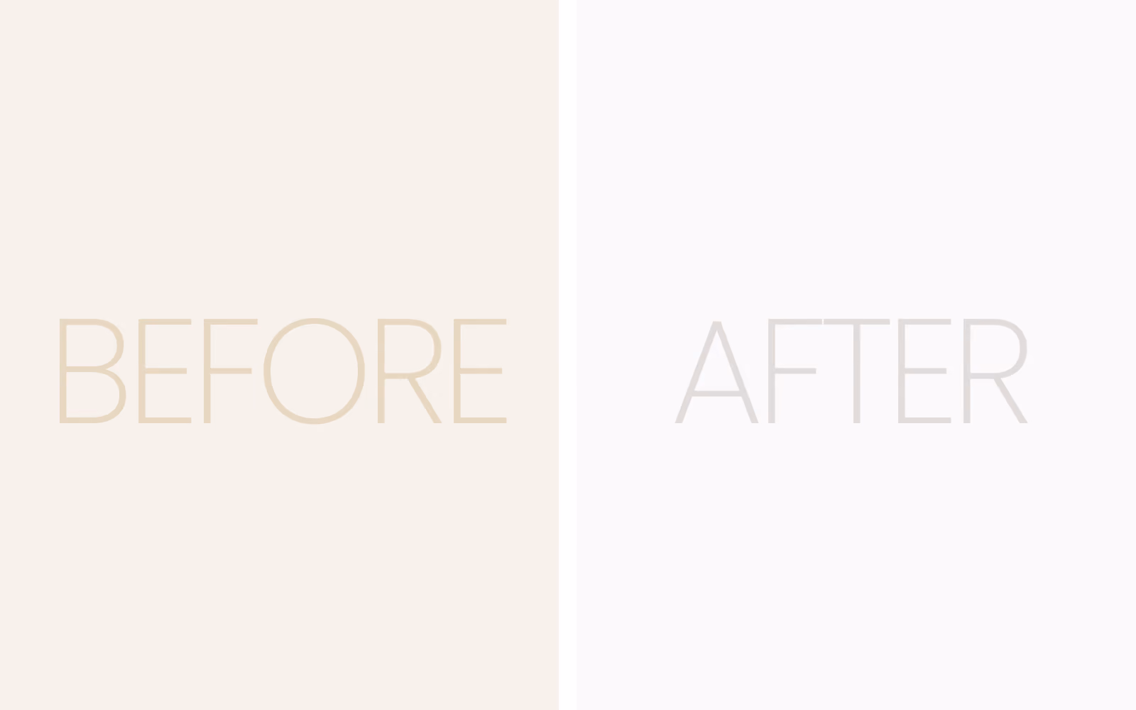 Botox Anti-Wrinkle Injections before and after result 1