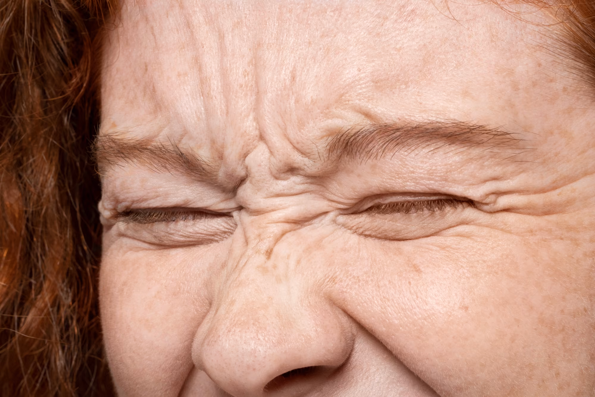 Botox Brow Lift
